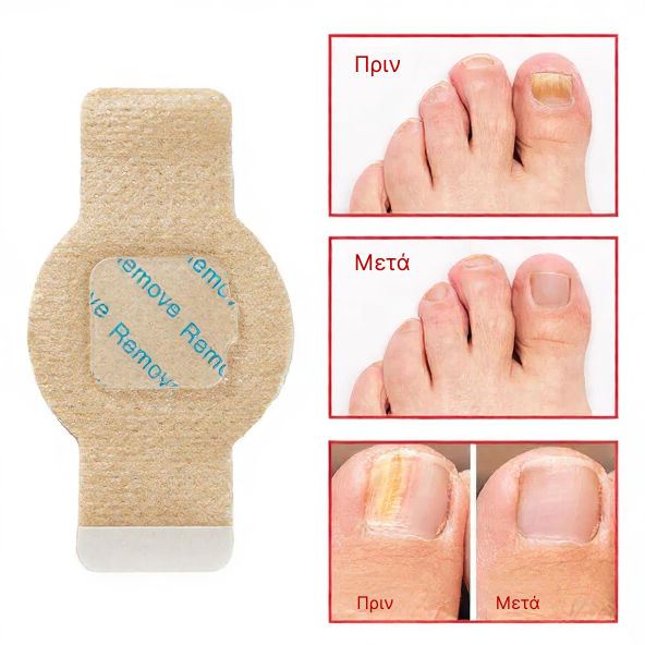 Elaimei™  Fungal Nail Patches