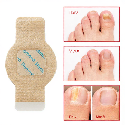Elaimei™  Fungal Nail Patches